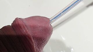 removing a trans urethral catheter
