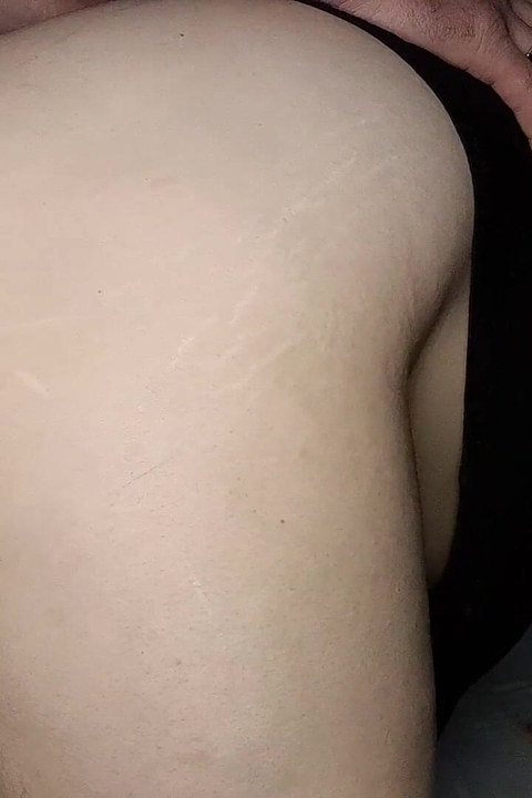 Anal Sex