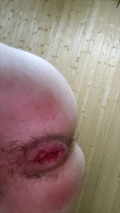 Anal close-up