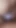 18 Years Old Bengali Beautiful Girl Hot Shudipa, Beautiful Boobs Shucking Tight 18 Pussy Fucking Xxx video. | Clip 2