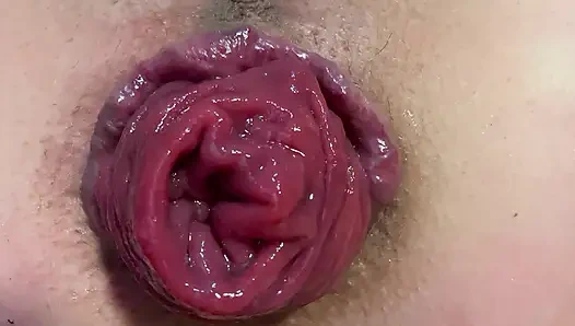 Spreizen und prolaps mein arschloch in nahaufnahme