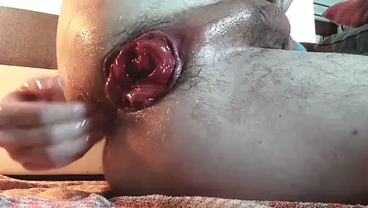 prolapsus oyun
