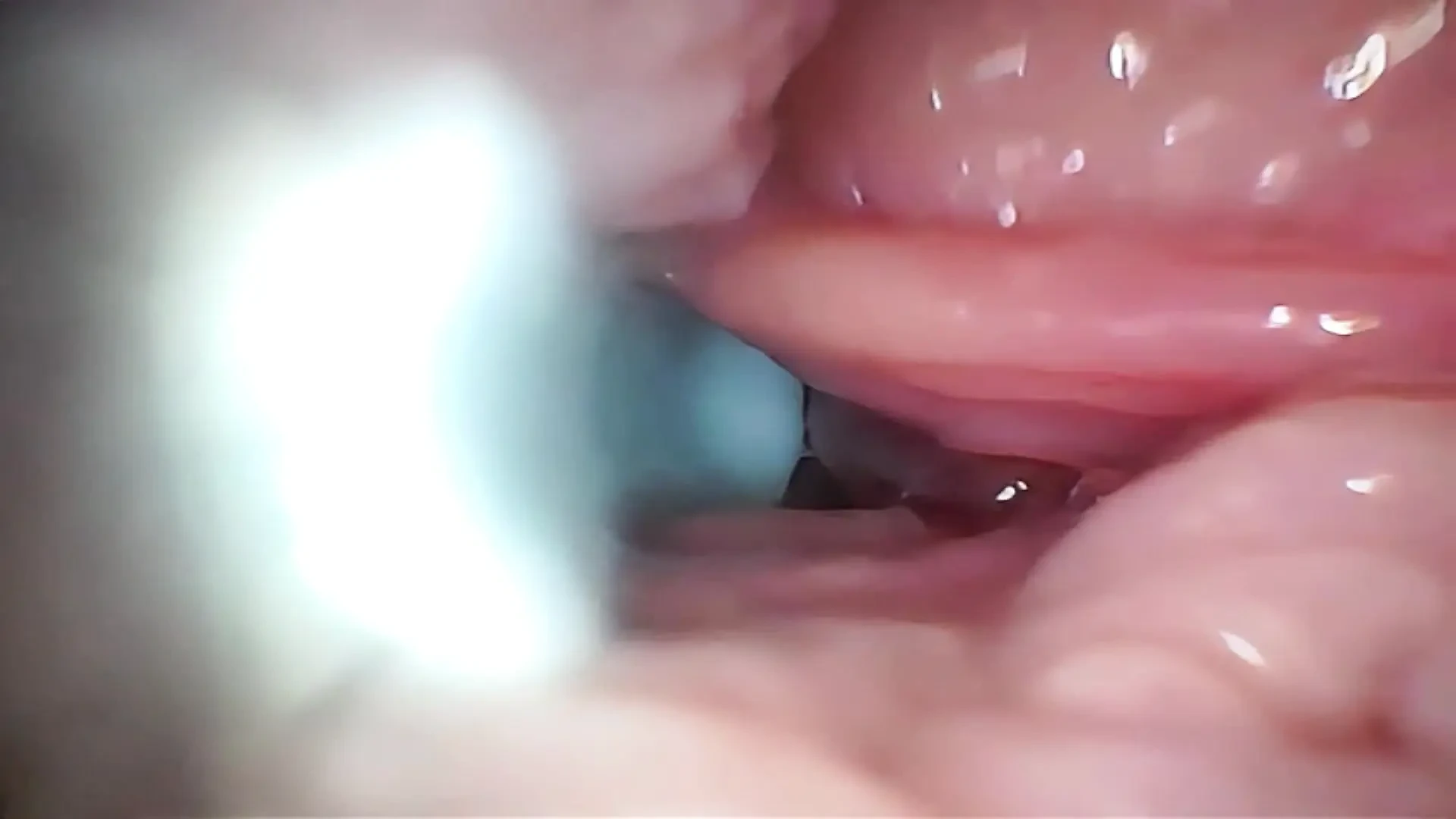 Semen in Cervix Wide Stretching Pussy Endoscope!