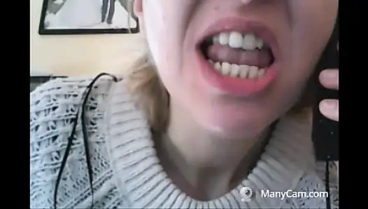 Chantal'ın dişleri çürümüş ve siyah dökülüyor