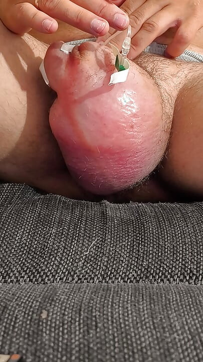 1100 ml D5Ns