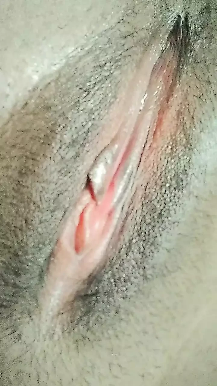 대박 클리토리스