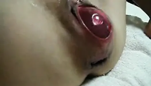 Japanese Extreme EW Insertion - ball in pussy 01
