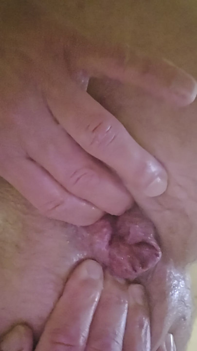 赛后洞