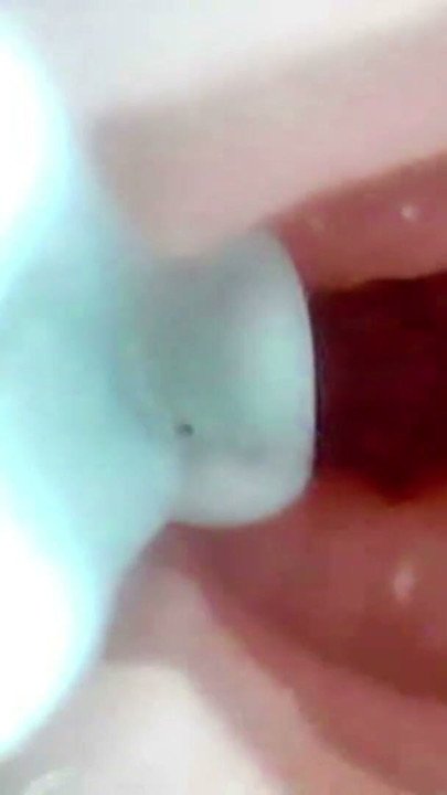 A detailed examination of Lopuza93 oral cavity and anal area using an endoscope camera. | Clip 3