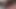 catheter in the cock VI with cumming 2014 01 29
