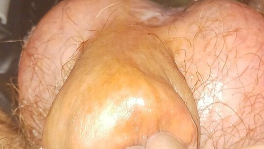CBT Bruning of Little Cock Head Gland with Cigarette Repeatedly