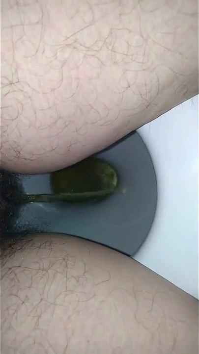 Mijando de um arbusto de chuva dourada de perto - Ginnagg