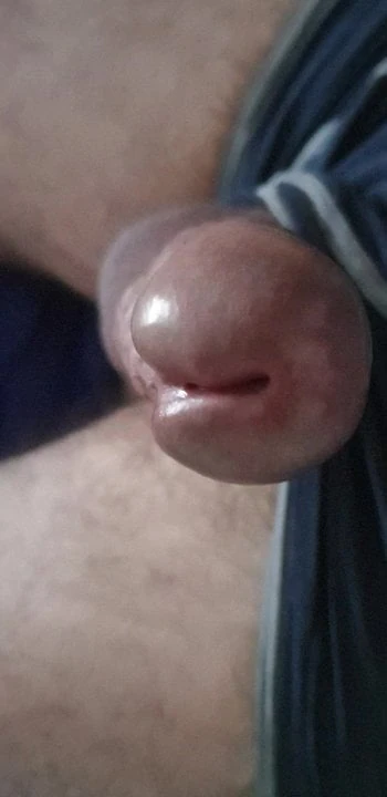 Myhotcock