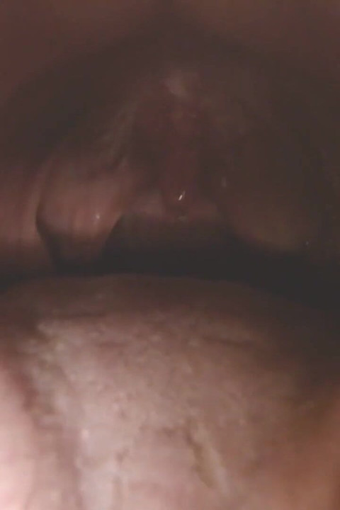 Keel en mond spugen strings uvula amandelen uvula