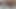 Lizzy Yum VR July 2023 JUST ANAL masturbation Post-Op Orgasm Pussy Clit ANAL Masturbation Teasing Orgasm