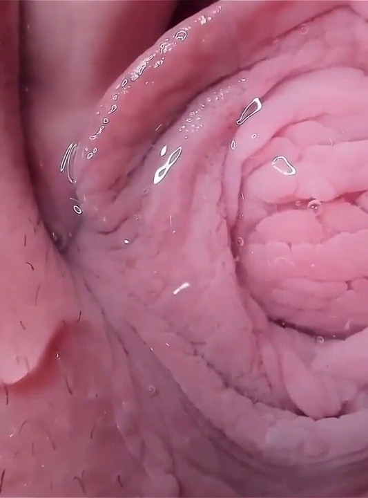내 안에 보기