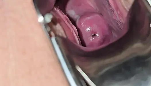 Милфа осматривает ее киску и вводит гинекологическое зеркало, чтобы увидеть внутри