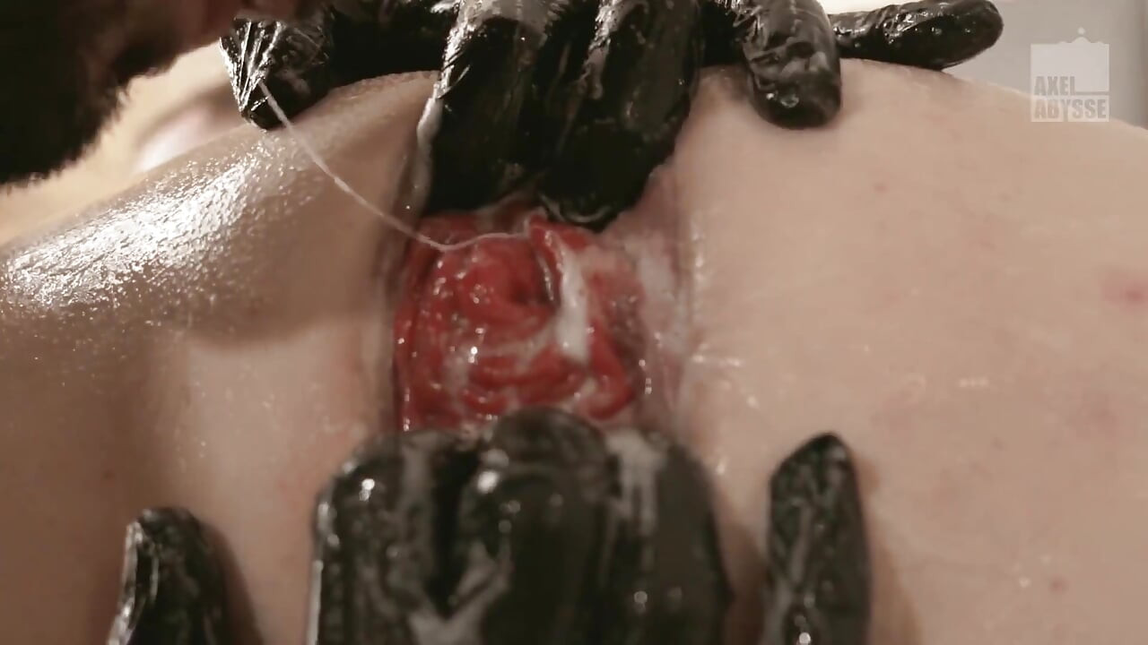 Axelabysse Eruption Part 1