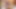 Foreskin Circumcision Roleplay Handjob