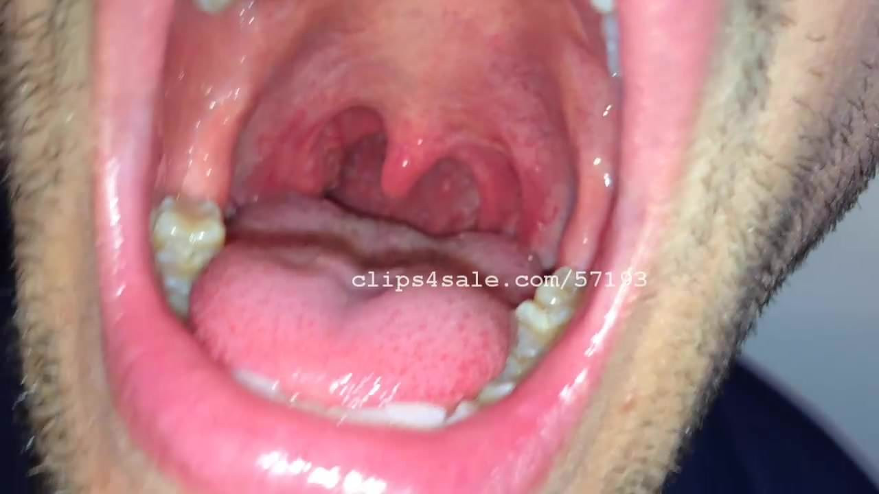 Mouth Fetish - Lance Mouth Part2 Video2
