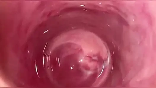 Kamera in vagina, Gebärmutterhals, pOV, creampie