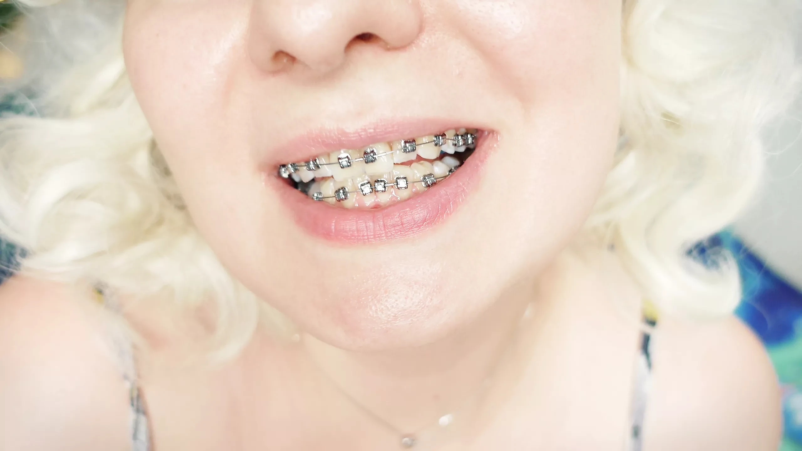 braces fetish: close up video mukbang ..