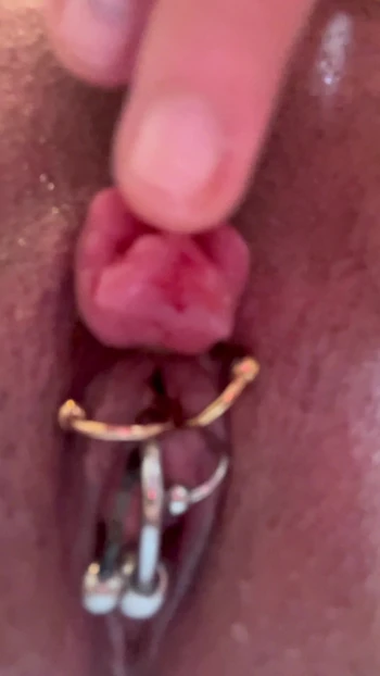 Enlarged clitoris bind