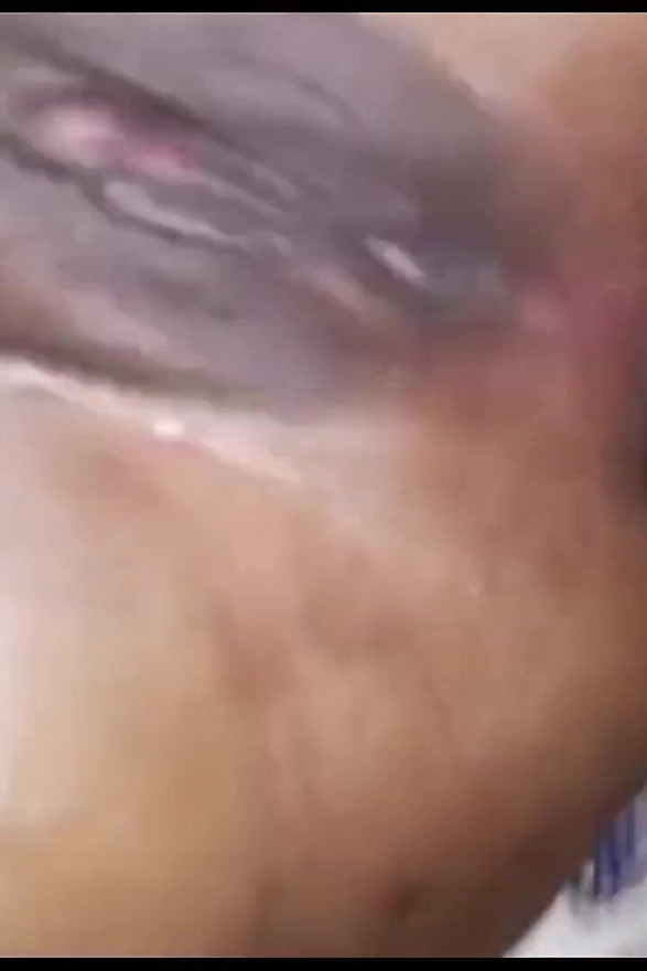 Part2. First Time Anal Fuck Slowly