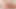 grandma prolapse her big cervix