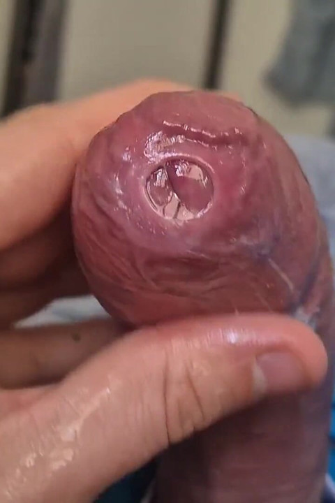 Phimosis Cock Precum Drip Close-up