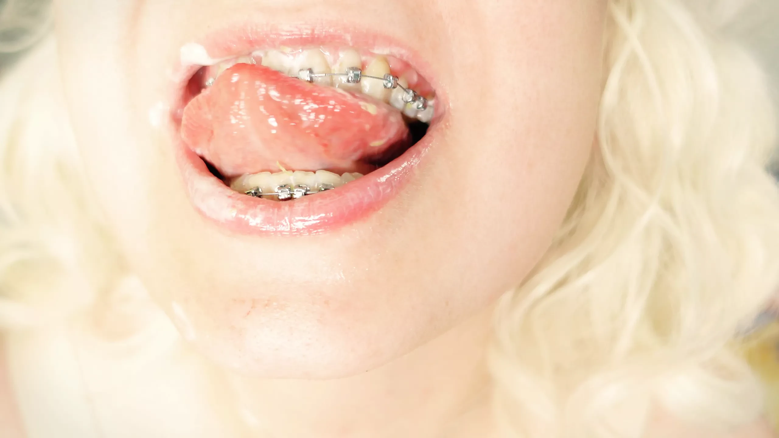 Braces tôn sùng - asmr clip ăn mukbang ...