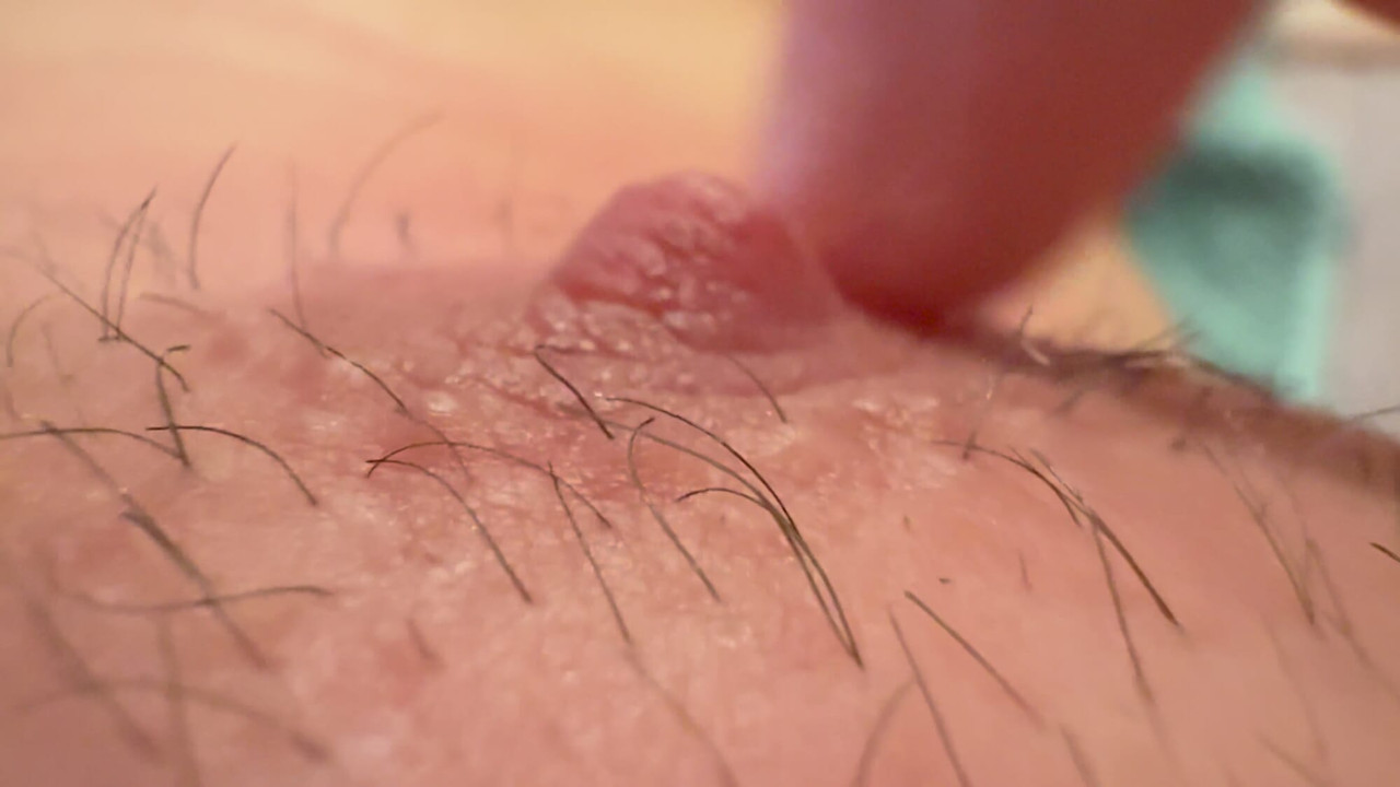 Sensitive nipple after waxing