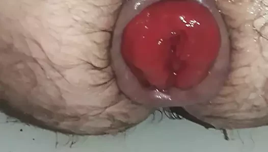 Göt sarkması
