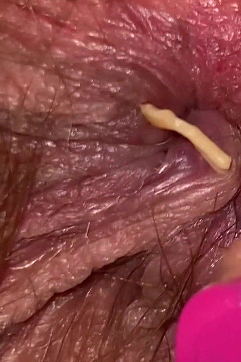Giantess fetish video hairy asshole extreme closeup