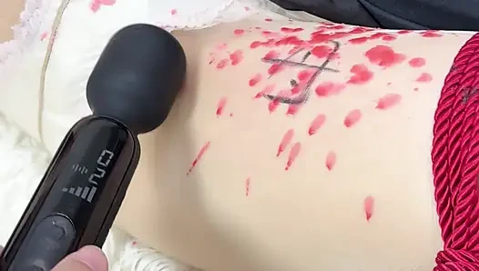 Damlama ağdası, anal kanca, m-leg