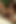 Masturbation