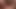 Miah Gold teaser 1