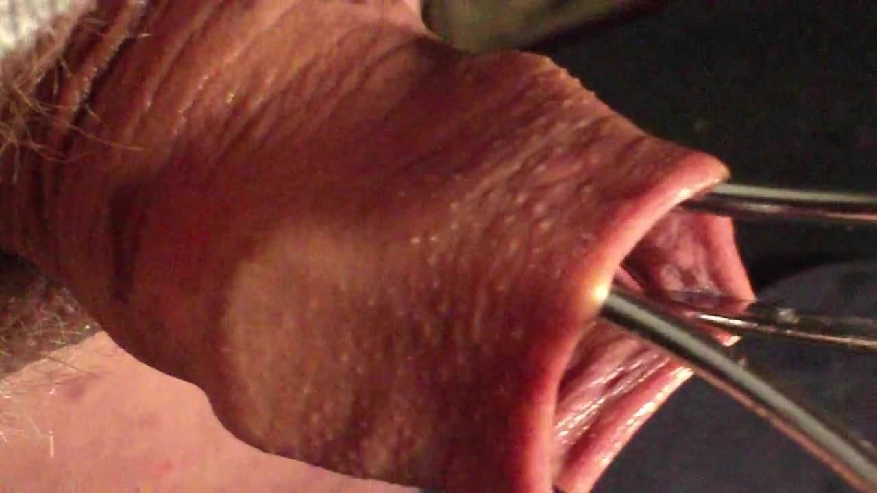 Sunday evening foreskin