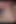 Aşırı self cbt anal