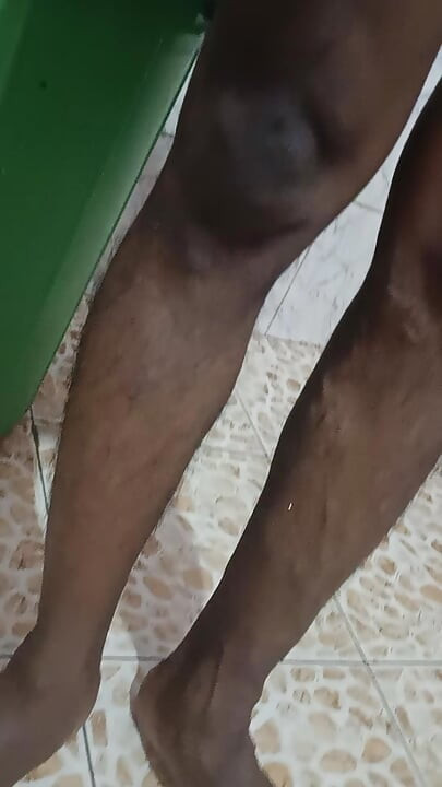 털이 무성한 후장