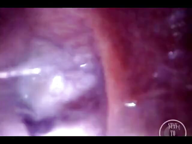 POV extrem tiefe anal erkundung! Schneller sichtbarer herzschlag