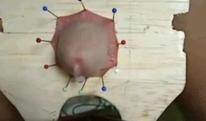 cbt