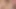 Lesbians Need More Attention at FuckingSkinny