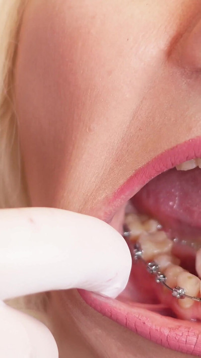 Must-see moment from "ASMR video: hot BRACES and double layer of medical nurse nitrile gloves (Arya Grander)"