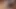 Keuschheits-Teaser