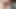 Teasing comp