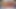 WreXWyldeXXX beatiful huge gaping prolapsed FF hole