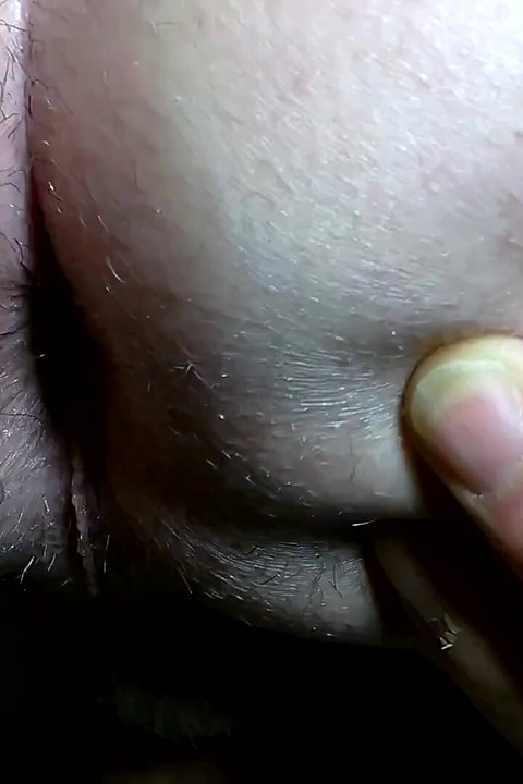 Meu buraco em close-up