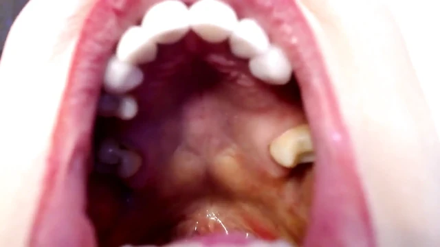 Big Wide Inside Both Girls Mouths
