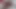 Lizzy Yum VR July 2023 JUST a SEXUAL MANIC Post-Op Orgasm Pussy Clit Masturbation